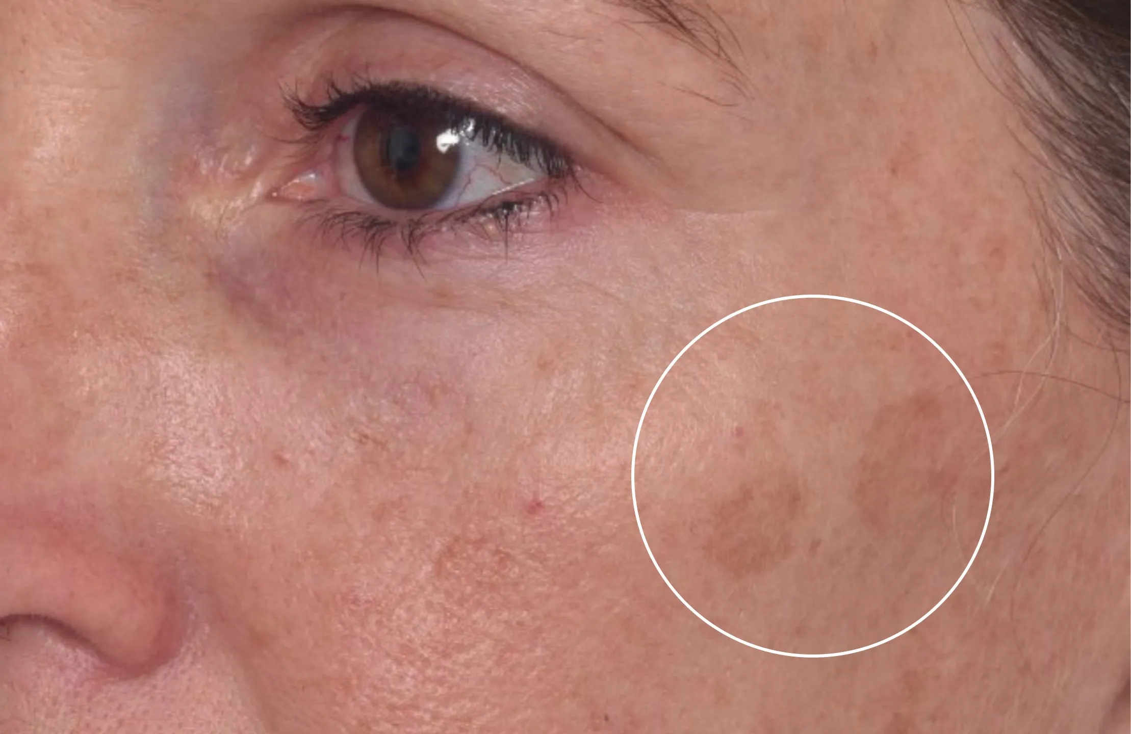 Rapid Dark Spot Correcting Serum